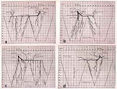Coronary Arteries: Normal Anatomy With Historical Notes and Embryology of Main Stems